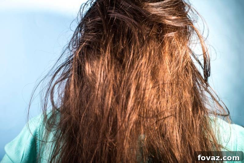 problem-scalp-greasy-dirty-hair-girl | homemade shampoo